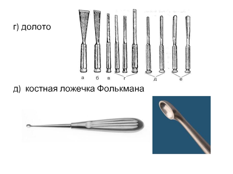 Хирургическая ложка фолькмана рисунок