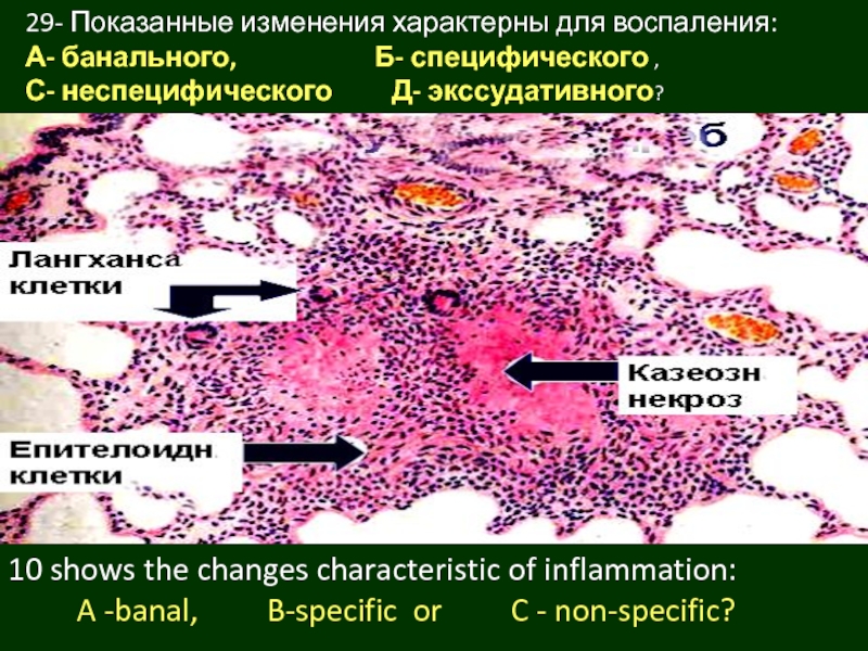 Воспаление патанатомия презентация