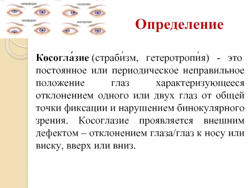 Презентация на тему косоглазие