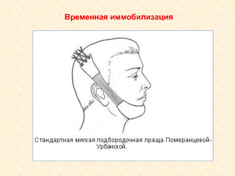 Методы временной и постоянной иммобилизации отломков челюстей презентация