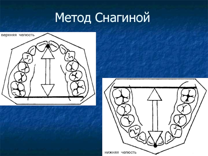 Селена 210 212 схема