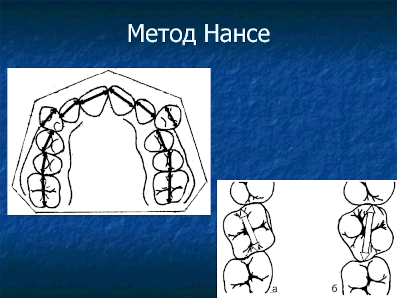 Селена 210 212 схема