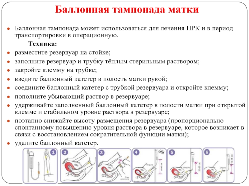 Баллонная тампонада матки презентация