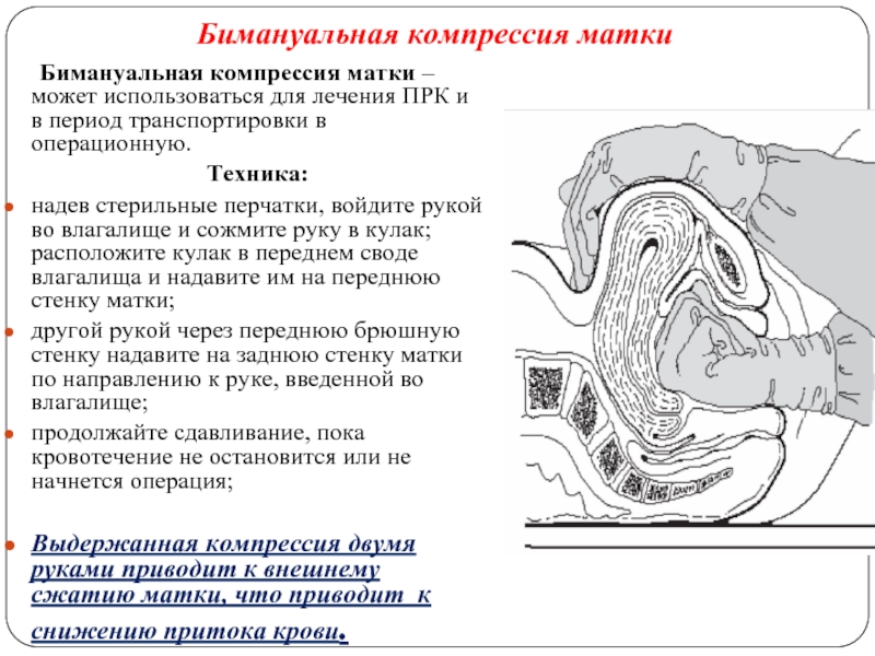 Послеродовое кровотечение презентация