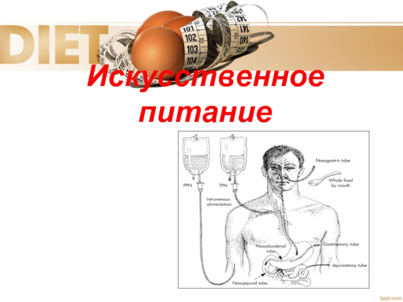 Искусственное питание. Основные принципы искусственного питания. Понятие об искусственном питании. Оснащение для искусственного питания.