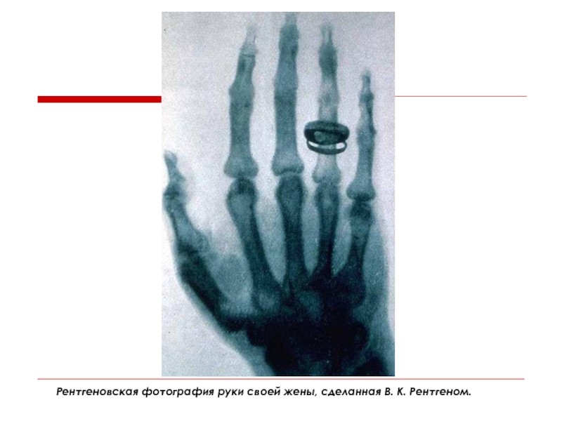 Разрешение рентгеновского изображения