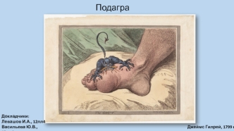 Подагра. Эпидемиология. Патогенез. Патоморфология