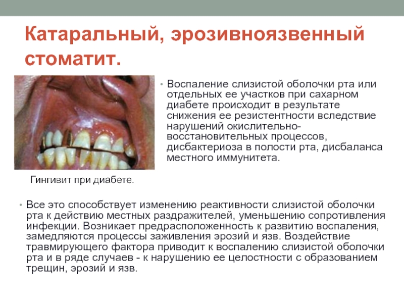 Реферат: Слизистая оболочка полости рта при заболеваниях эндокринной системы