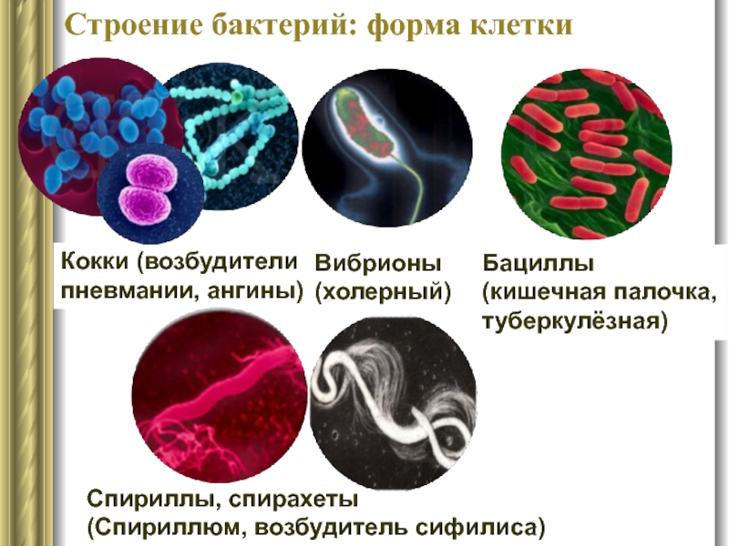 Строение бактерий: форма клетки Вибрионы (холерный) Кокки (возбудители пневмании, ангины) Бациллы (кишечная