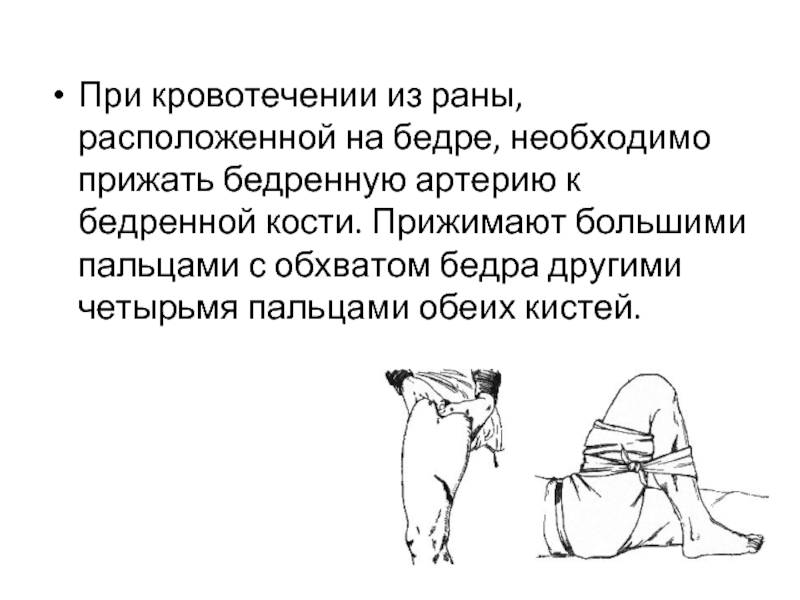 Кровотечение бедра. Сестринское вмешательство при кровотечении из бедренной артерии. При кровотечении из бедренной артерии необходимо.. При сильном кровотечении из раны бедра необходимо.