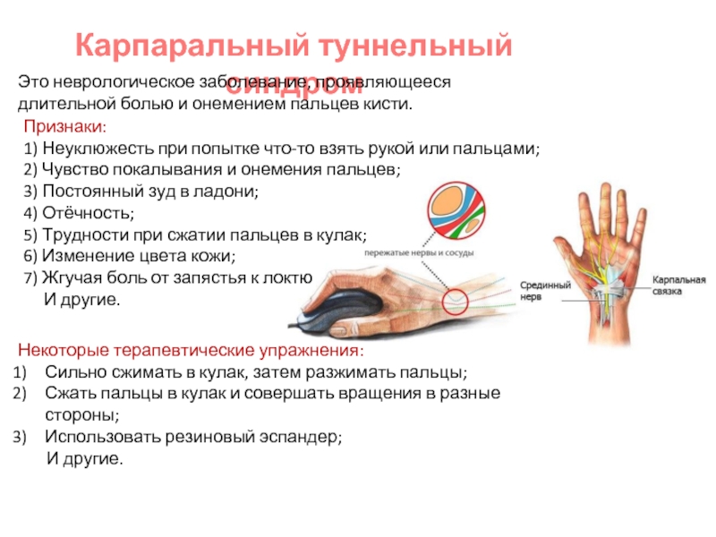 Болит сустав у основания большого пальца руки