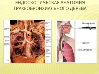 Эндоскопическая анатомия трахеобронхиального дерева