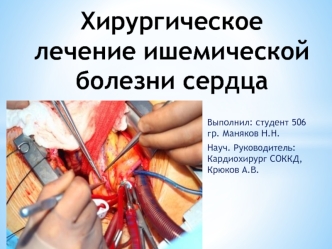 Хирургическое лечение ишемической болезни сердца