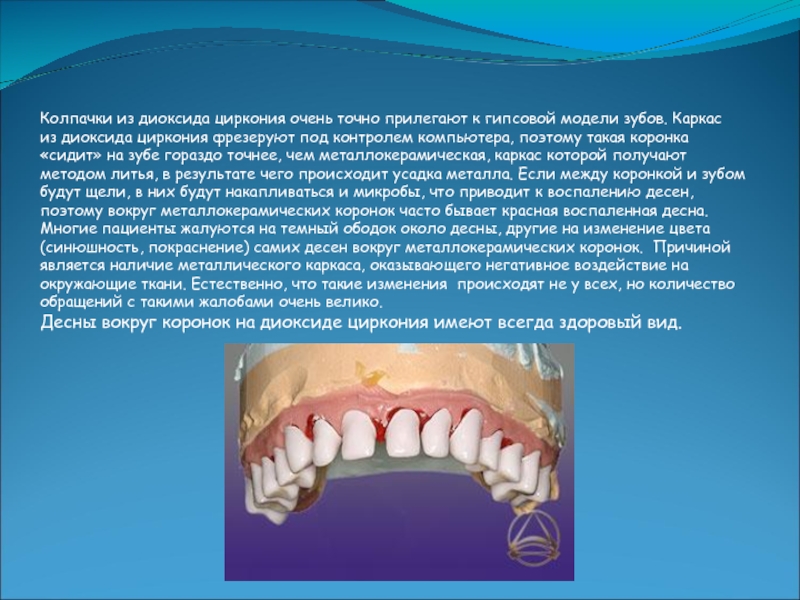 Диоксид циркония в стоматологии презентация