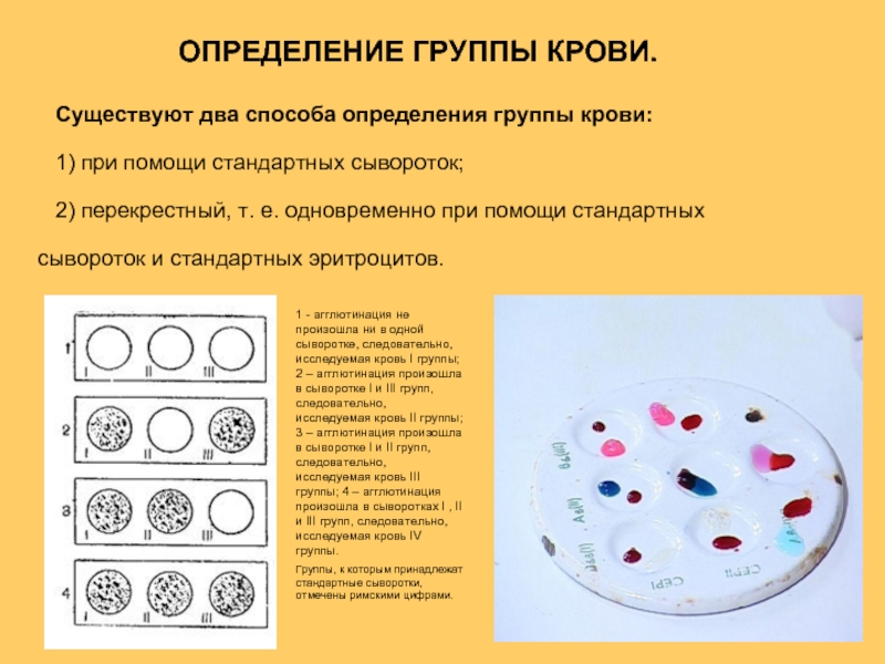 Современные методы определения группы крови презентация