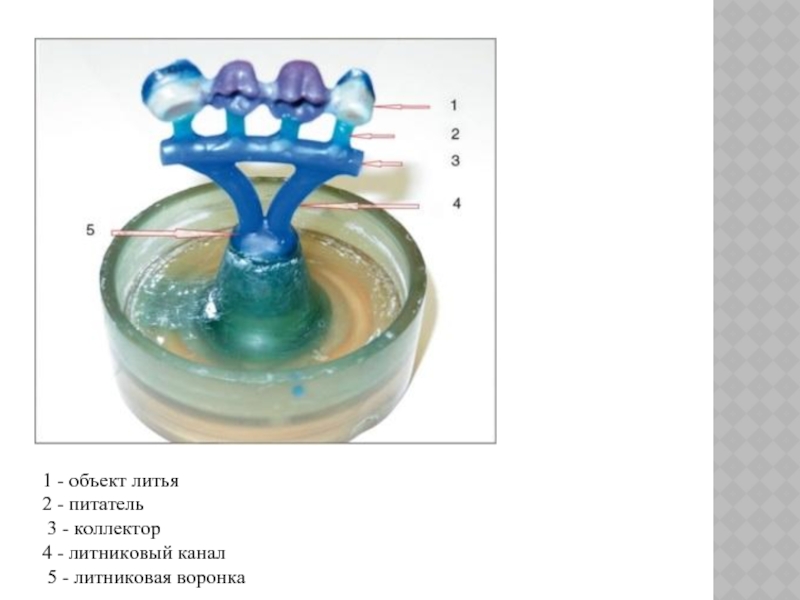 Создание литья. Литниковая система и литниковые каналы. Литниковая система в стоматологии. Основные элементы литниковой системы. Литниковая воронка в стоматологии.