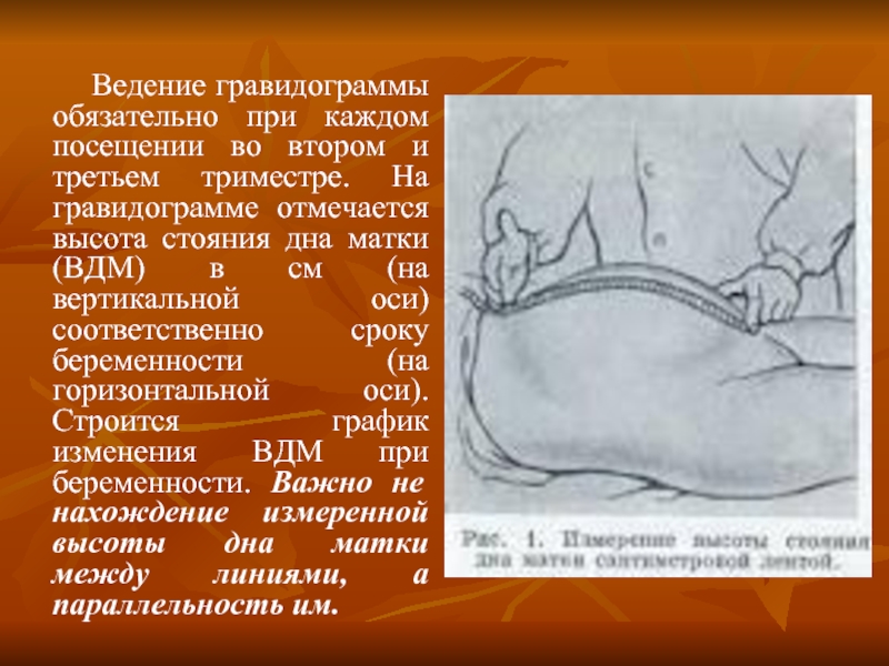 Стояние матки. Гравидограмма измерение ВДМ. Высота стояния дна матки в третьем триместре. Высота стояния дна матки Гравидограмма. График высота стояния дна матки.