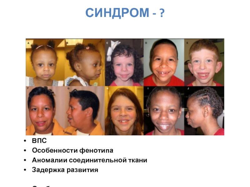 Фенотип ребенка с синдромом дауна. Фенотипические особенности. Фенотип человека. Фенотипические особенности у женщины, фото.