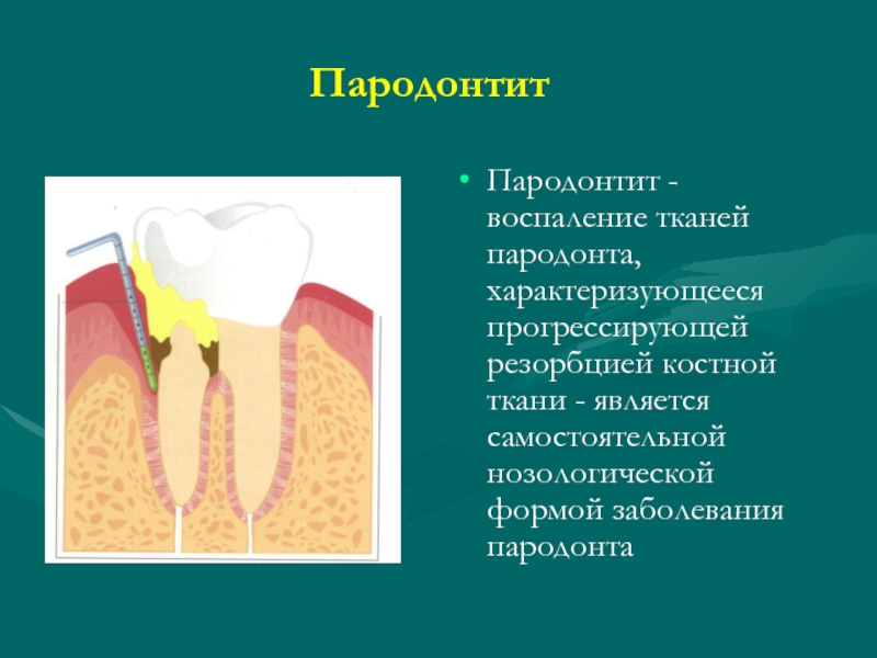 Понятие о пародонтальном комплексе особенности функционирования и биомеханики пародонта презентация