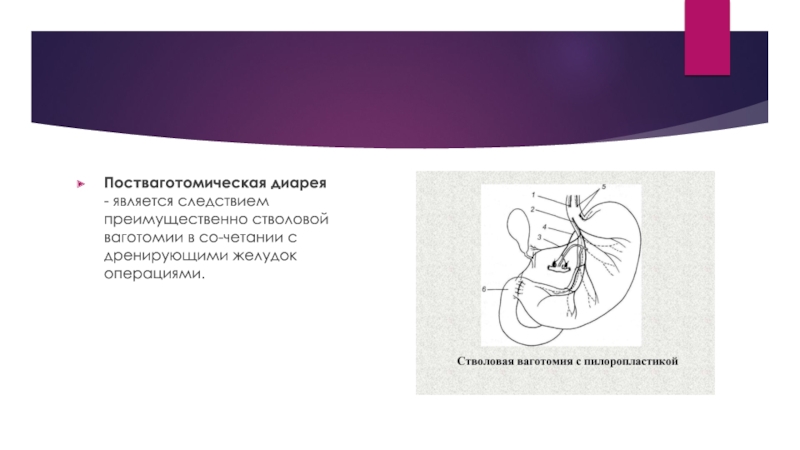 Постваготомический синдром презентация