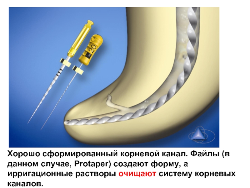 Ирригация корневых каналов презентация