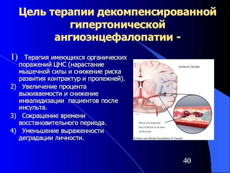 Цель терапии декомпенсированной гипертонической ангиоэнцефалопатии -1)  Терапия имеющихся органических поражений