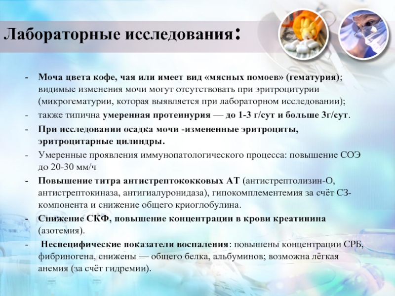 Моча цвета мясных помоев при гломерулонефрите