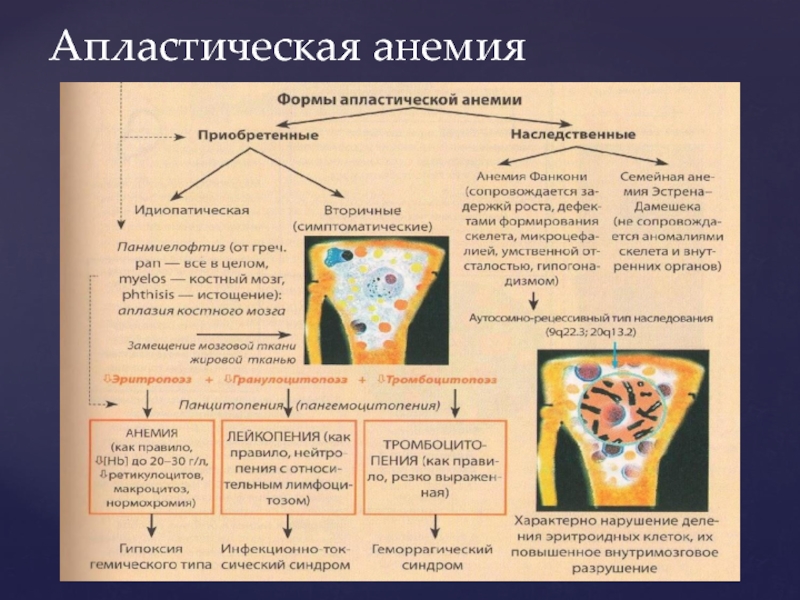 Клиническая картина приобретенной апластической анемии складывается из синдромов кроме