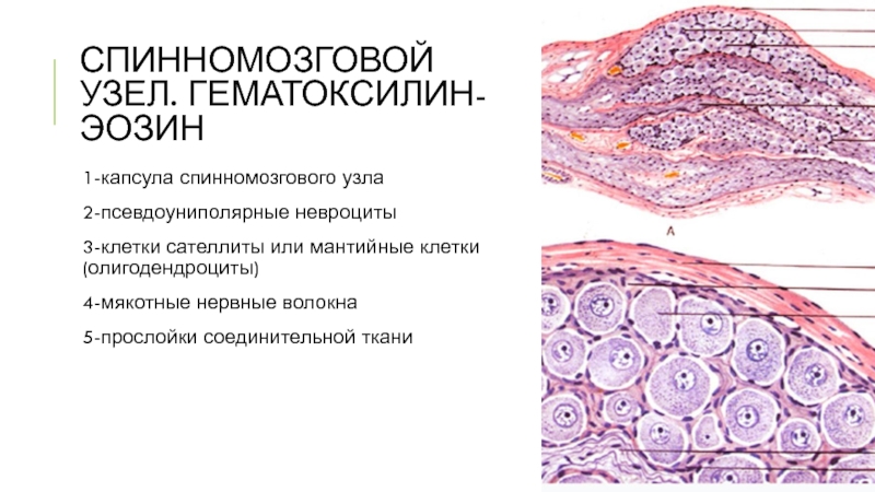 Спинномозговой узел гистология рисунок