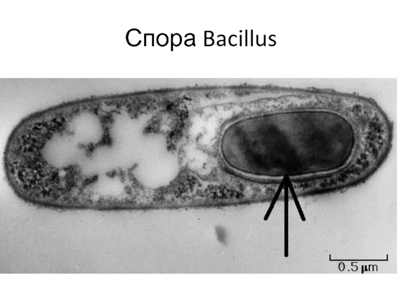 Спора Bacillus