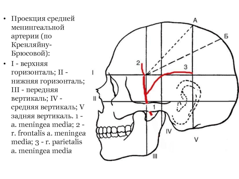 Проекция средней менингеальной артерии по схеме кренлейна брюсовой