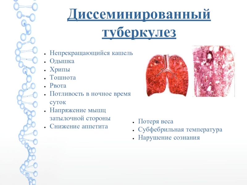 Туберкулез биология. Туберкулез бактериальное заболевание. Клиника туберкулеза. Клиника туберкулеза кратко.