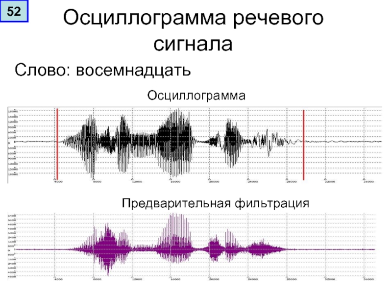 Гудки звуки вызова. Осциллограмма речевого сигнала. Осциллограмма сигнала изображения 720p. Осциллограмма звукового сигнала. Осциллограмма цветоразностного сигнала.
