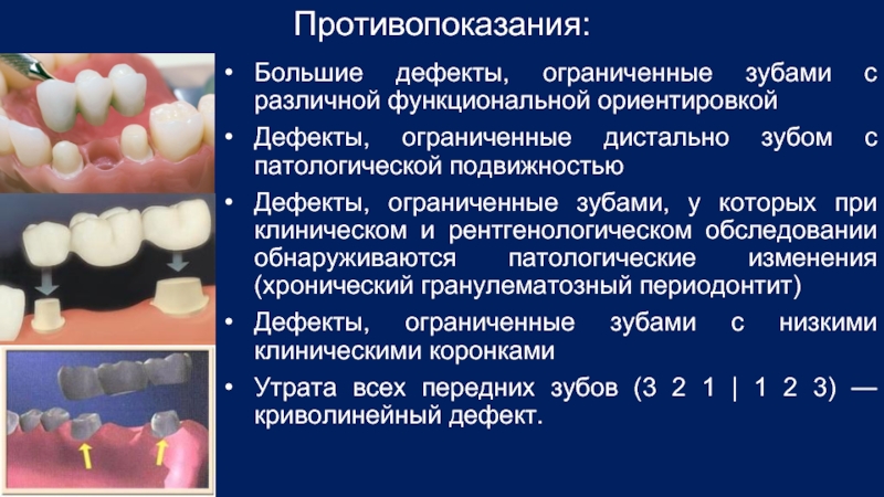 Обследование пациентов с обширными дефектами зубных рядов презентация