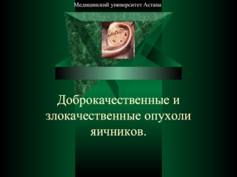 Доброкачественные и злокачественные опухоли яичников