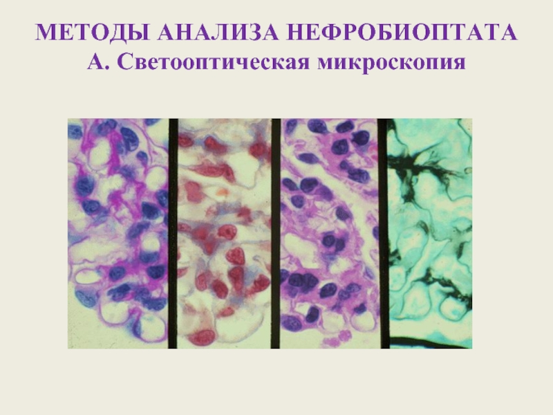 Микроскопией называют метод микроскопии. Светооптическая микроскопия опухоли. Микроскопический метод. Микроскопические методы. Микроскопический метод исследования.