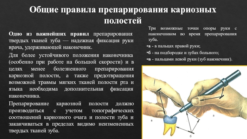 Принципы препарирования кариозных полостей