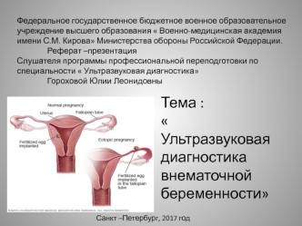 Ультразвуковая диагностика внематочной беременности