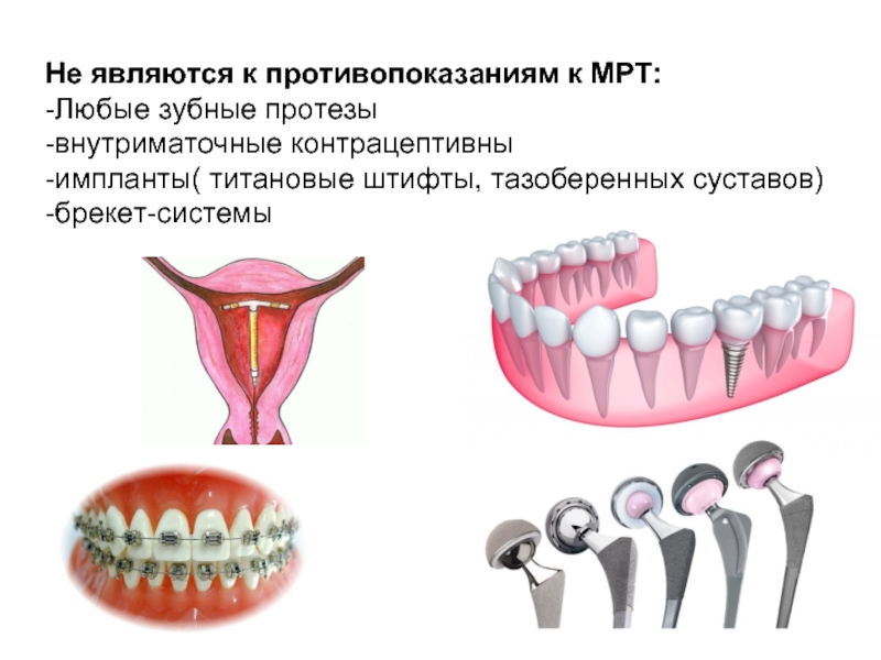 Можно ли с зубным имплантом делать мрт. Противопоказания к имплантации зубов. Противопоказания к протезированию зубов. Зубные импланты противопоказания.