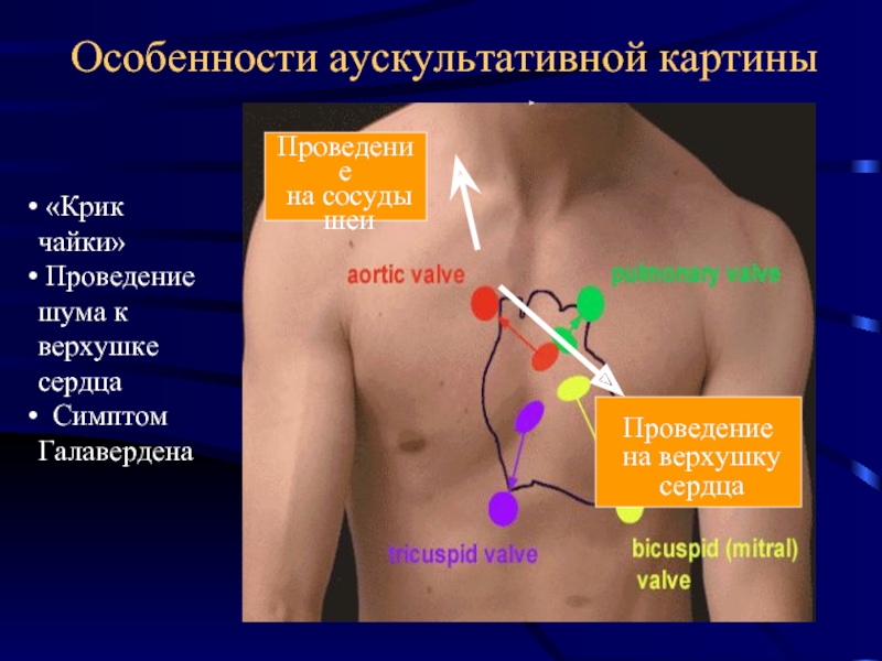 Особенность аускультативной картины сердца у детей тест с ответами