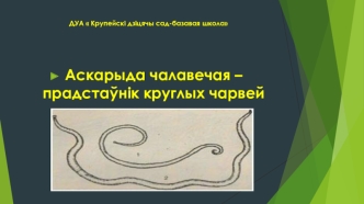 Аскарыда чалавечая – прадстаўнік круглых чарвей