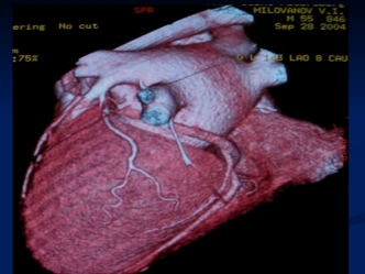 Методы лучевого исследования сердца