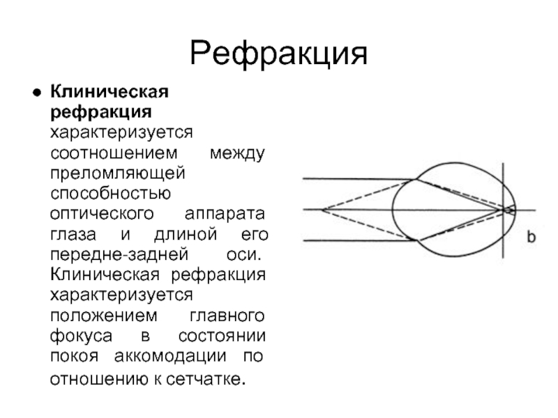 Рефракция это. Рефракция и аккомодация. Рефракция и аккомодация глаза. Клиническая рефракция глаза. Преломляющая способность оптического аппарата глаза.