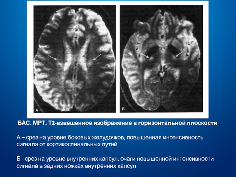 Мрт взвешенное изображение это