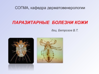 Чесотка, паразитарное заболевание кожи