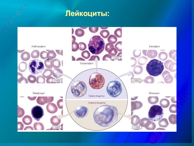 Лейкоциты в моче картинки