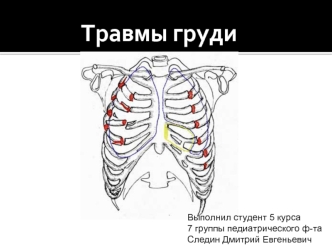 Травмы груди