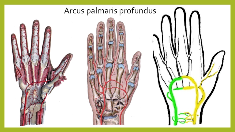 Montagem vozes profundus. Arcus Palmaris. Arcus Palmaris Profundus. Arcus Palmaris Profundus образована. Arcus Palmaris superficialis.