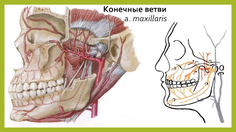 Sinus maxillaris стенки