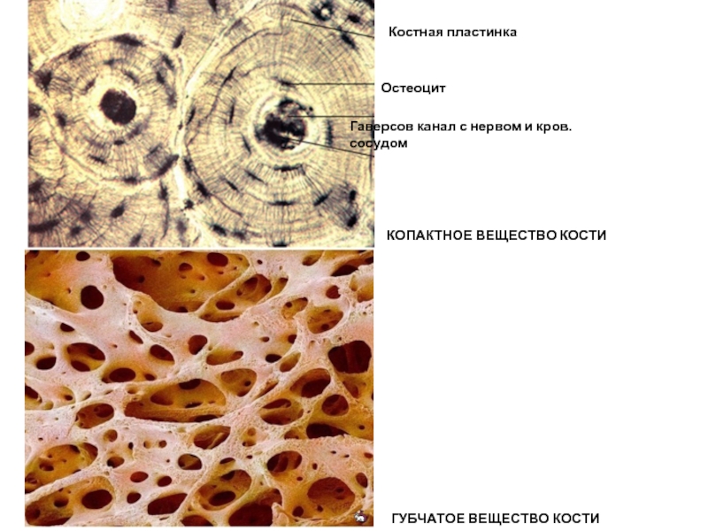 Костные пластинки